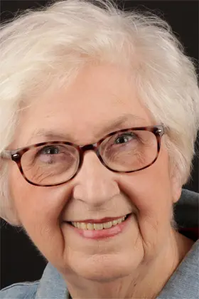 Confident patient smile post smile rehabilitation with dental implants and crowns.